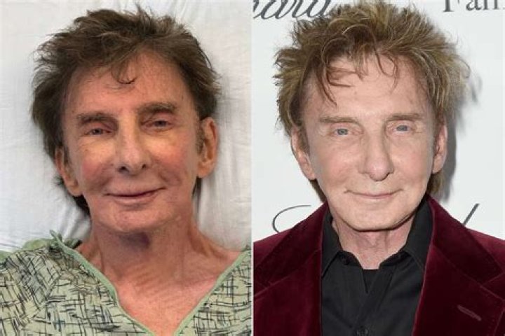 Is Barry Manilow's Illness Behind His Health Struggles?